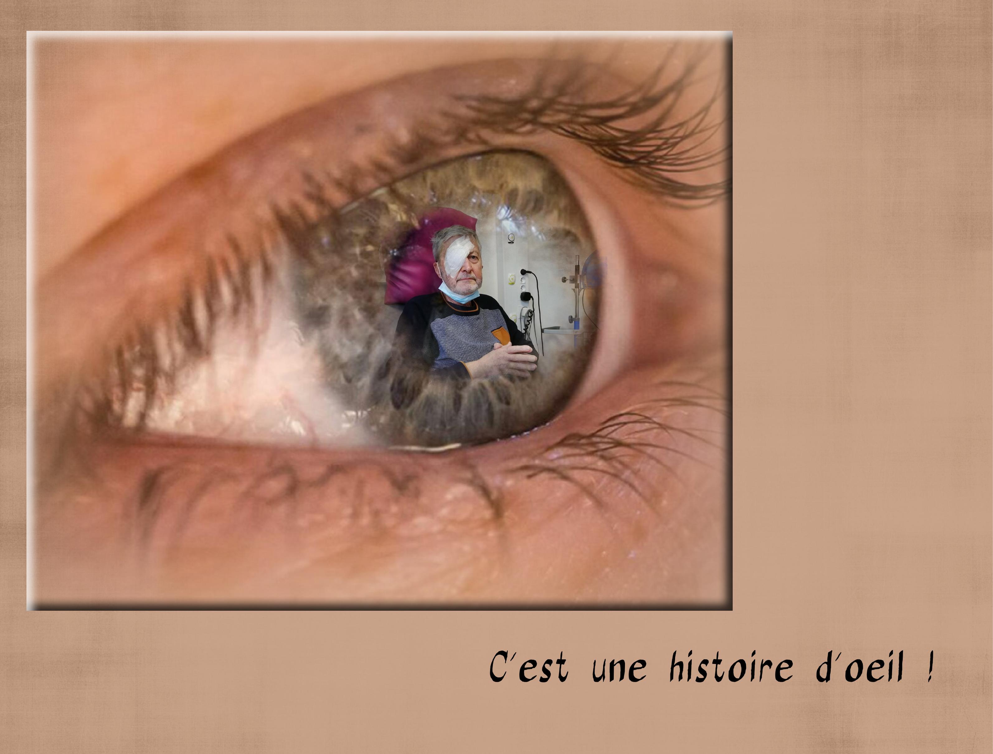 C'est une histoire d'oeil