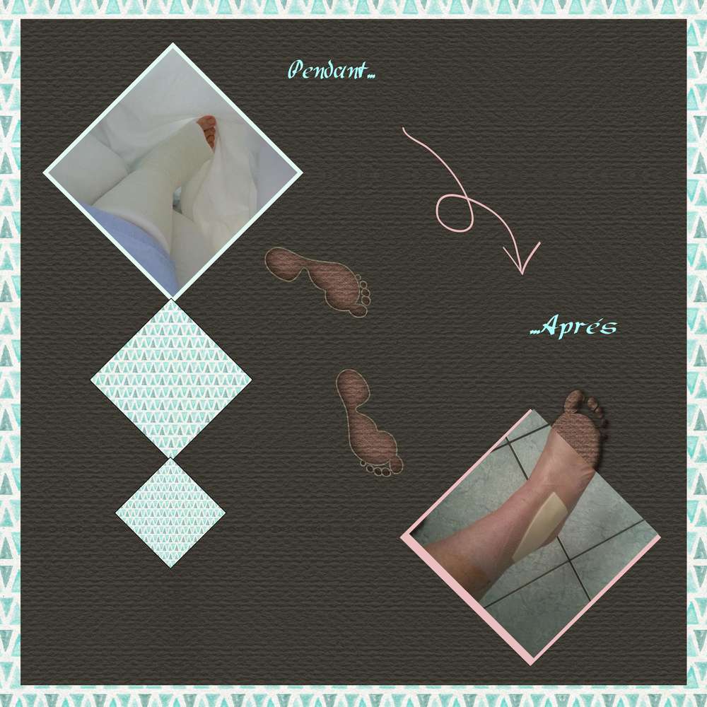 chirurgie_orthop__dique_suite