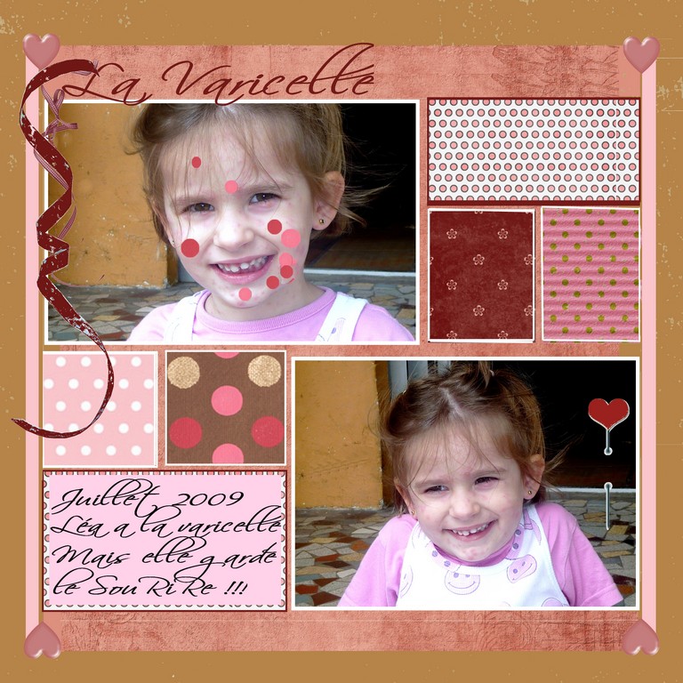 La varicelle