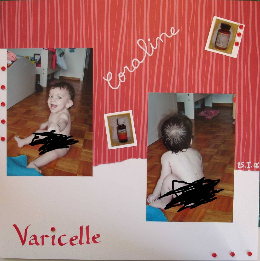 Varicelle - dernière !